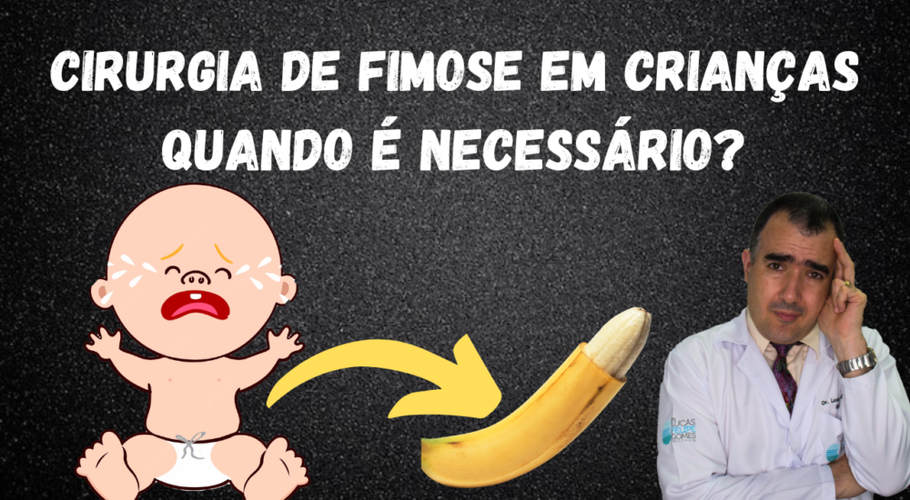 Fimose E Parafimose Entenda Suas Diferenças Dr Lucas Felipe Gomes Urologista