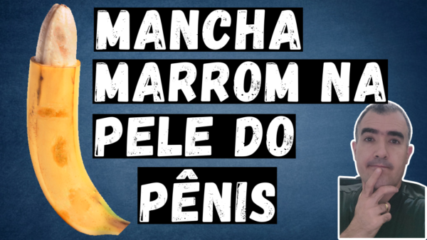 Mancha Marrom na Pele do Pênis - Dr. Lucas Felipe Gomes - Urologista
