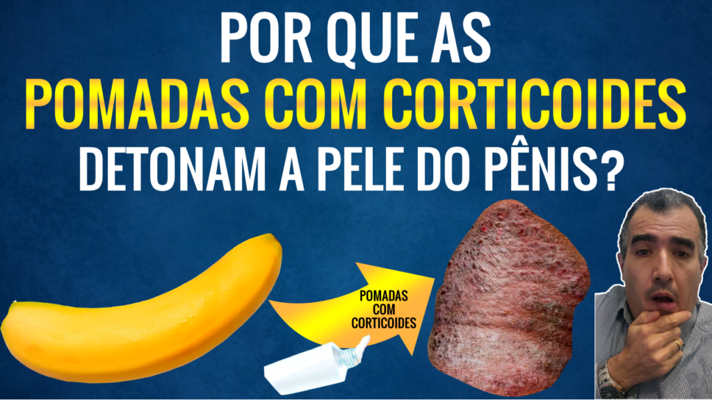 Pomadas Com Corticoides Na Regi O Genital Problemas E Precau Es Dr Lucas Felipe Gomes