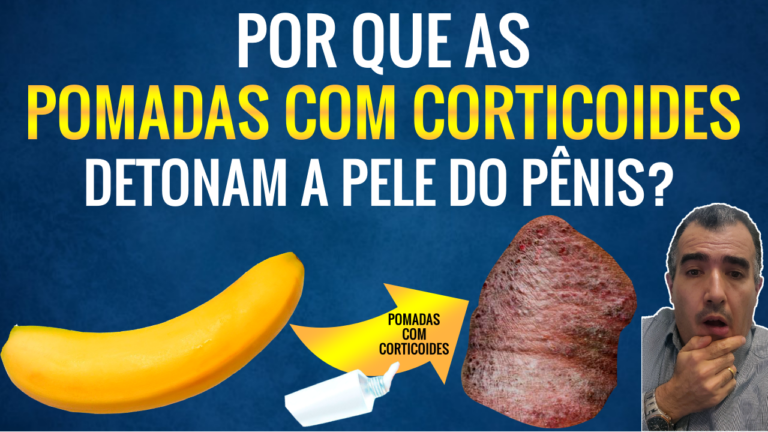 Pomadas com Corticoides na Região Genital: Problemas e Precauções - Dr ...