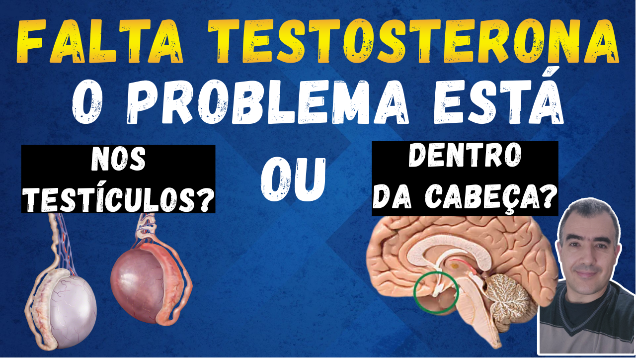 Hipogonadismo Masculino: Primário Ou Secundário? - Dr. Lucas Felipe ...