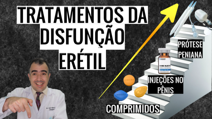 Guia Simplificado Sobre O Tratamento Da Disfunção Erétil Dr Lucas Felipe Gomes Urologista 4626