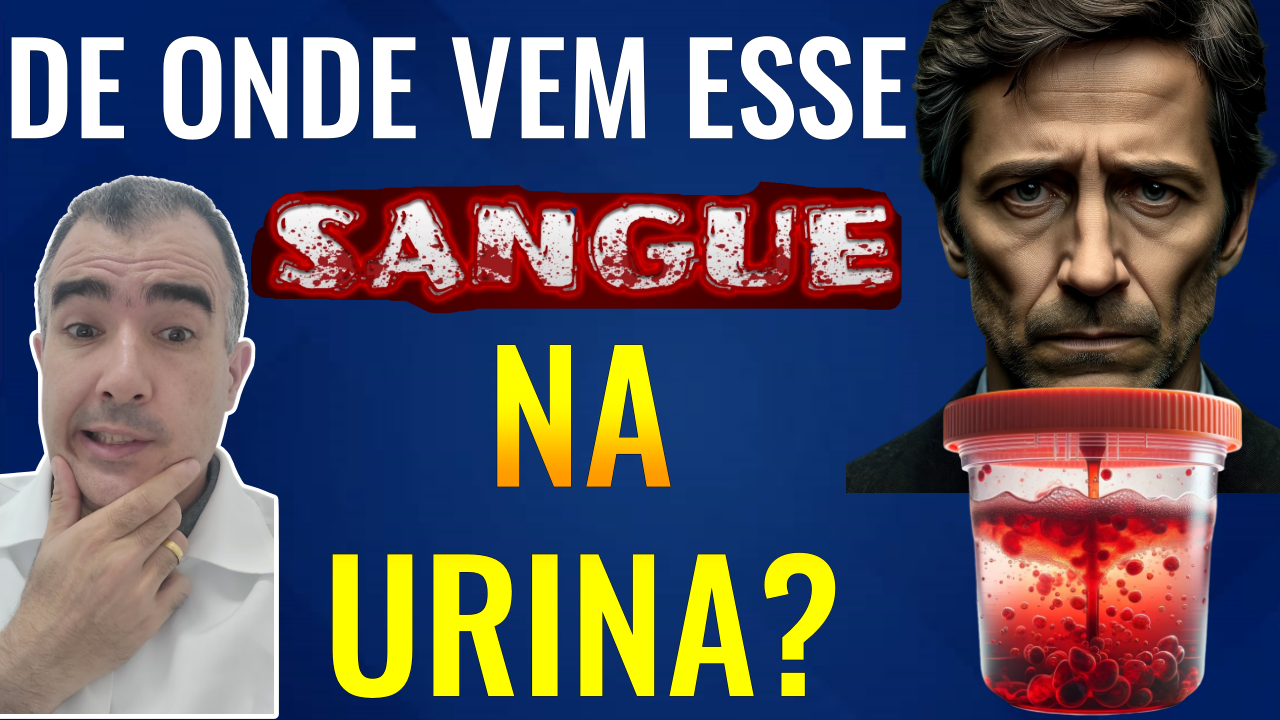 Entendendo a Hematúria: O Que o Sangue na Urina Pode Indicar - Dr ...