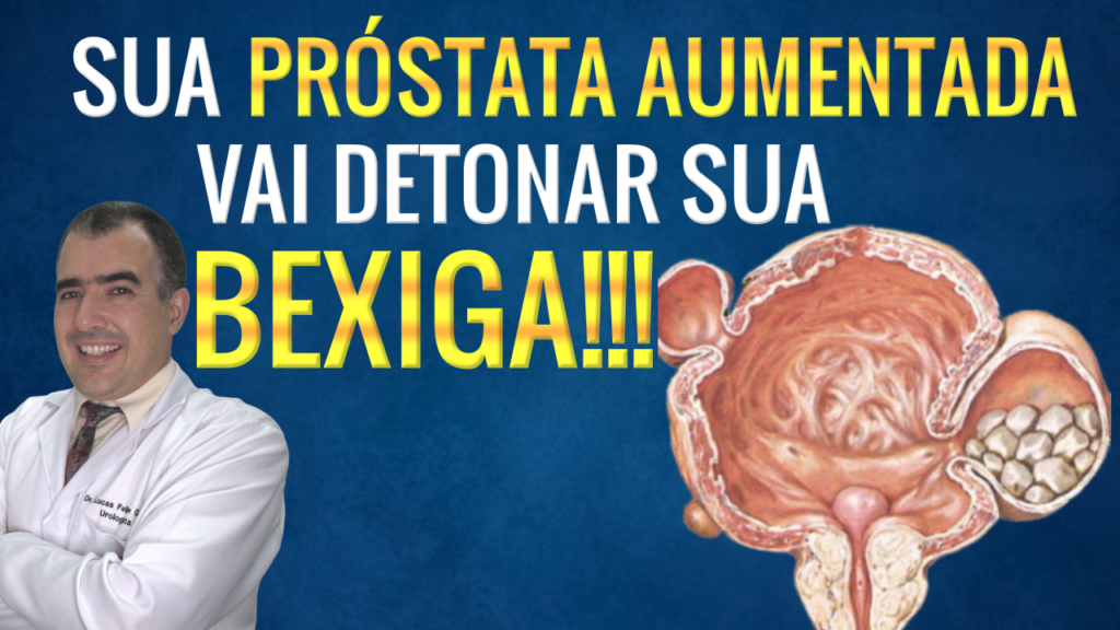 Como identificar um caroço ou nódulo no testículo - Dr. Lucas Felipe ...